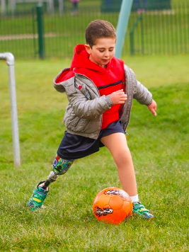 Prosthetics pediatrics